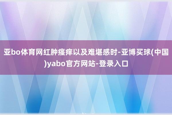 亚bo体育网红肿瘙痒以及难堪感时-亚博买球(中国)yabo官方网站-登录入口